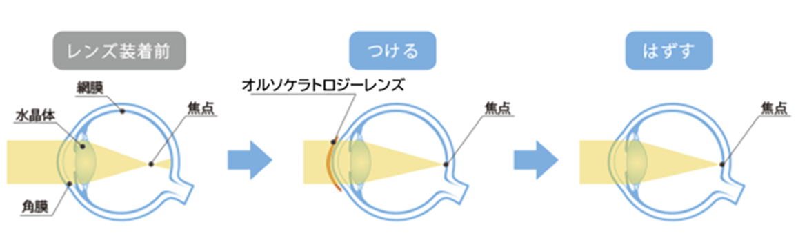 図：レンズ装着前、装着時、外した時の様子